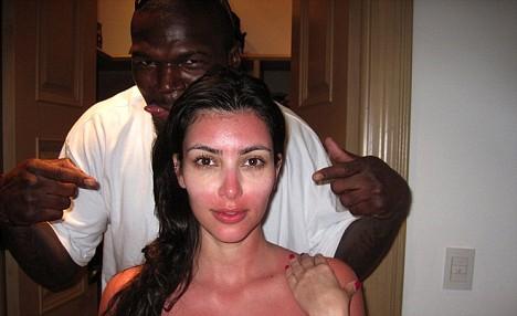 Ким Кардашьян сожгла лицо