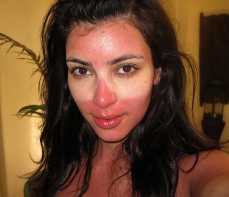 Ким Кардашьян сожгла лицо