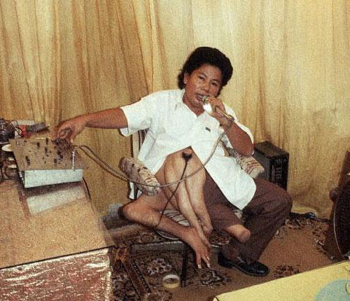 "Короли уродства": трёх, четырёх и… пятиногие люди