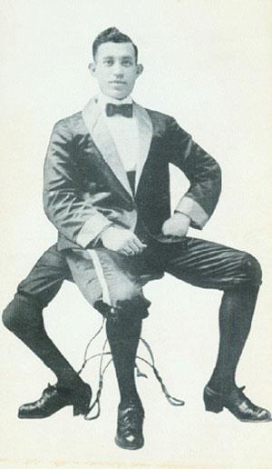 "Короли уродства": трёх, четырёх и… пятиногие люди