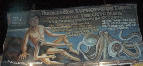 "Короли уродства": трёх, четырёх и… пятиногие люди