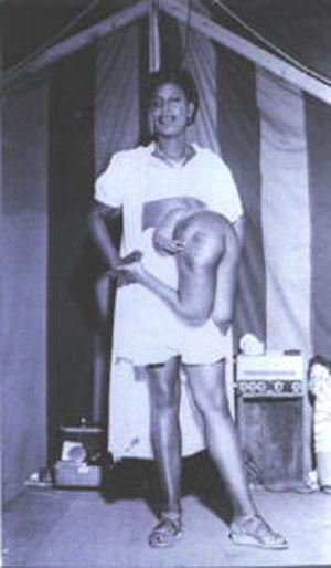 "Короли уродства": трёх, четырёх и… пятиногие люди