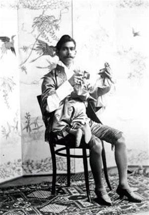 "Короли уродства": трёх, четырёх и… пятиногие люди