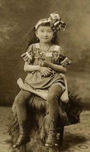 "Короли уродства": трёх, четырёх и… пятиногие люди