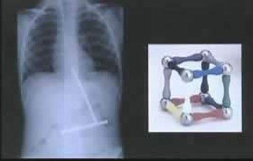 Шокирующие предметы, найденные в человеческих желудках