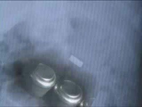 Шокирующие предметы, найденные в человеческих желудках