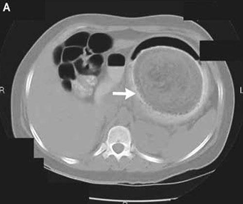 Шокирующие предметы, найденные в человеческих желудках
