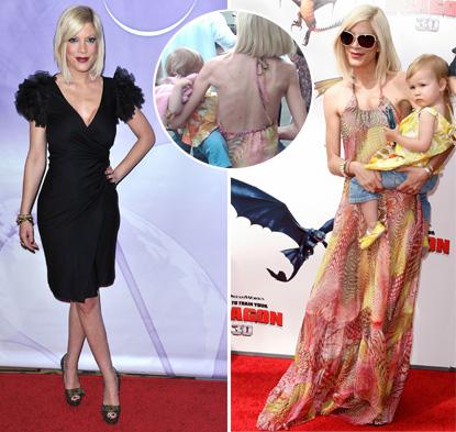 Знаменитости, которые довели себя диетами