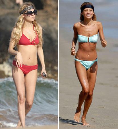 Знаменитости, которые довели себя диетами