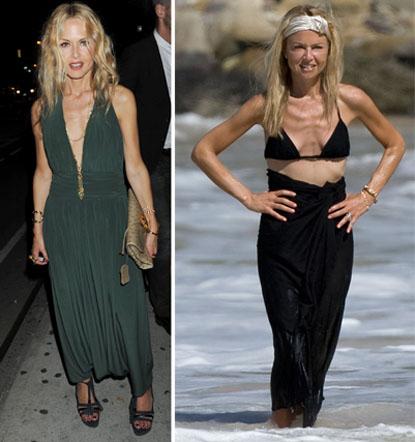 Знаменитости, которые довели себя диетами