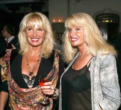 Самые знаменитые звезды-близнецы