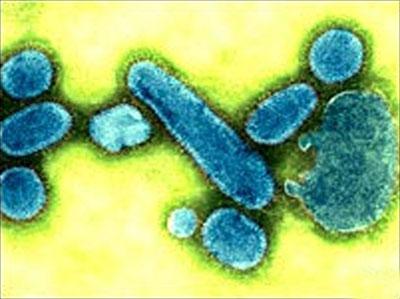 Правда, некоторые ученые считают, что к столь многочисленным жертвам привел вовсе не грипп, а какое-то другое, еще неизвестное заболевание. Дескать, вирусология в те годы находилась в зачаточном состоянии и не смогла однозначно выявить возбудителя болезни... Но все это бездоказуемо, а пандемии гриппа бушуют до сих пор...