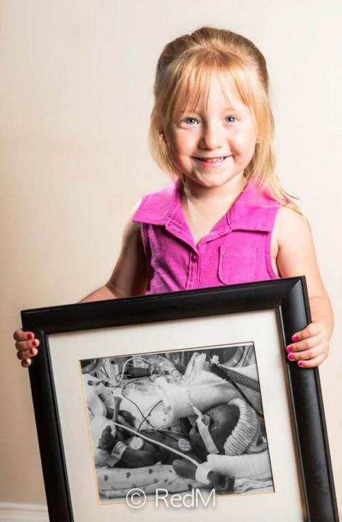 Недоношенные дети с фото, сделанными сразу после рождения.