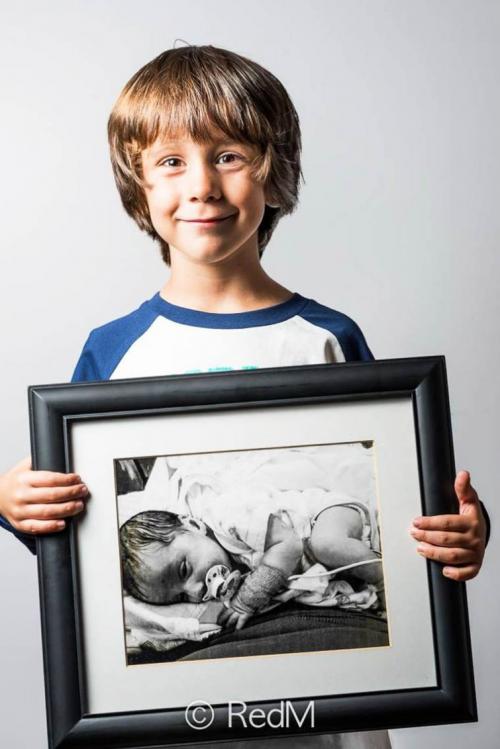 Недоношенные дети с фото, сделанными сразу после рождения.