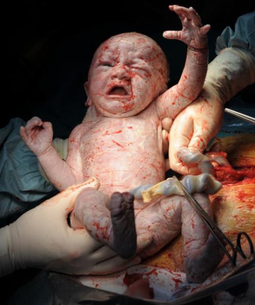 Потрясающие снимки рождения и первых секунд жизни
