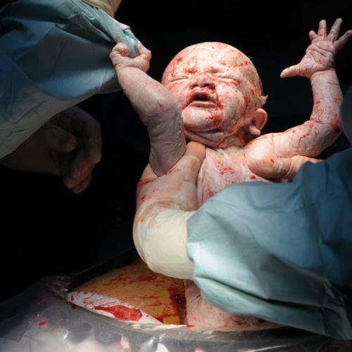 Потрясающие снимки рождения и первых секунд жизни