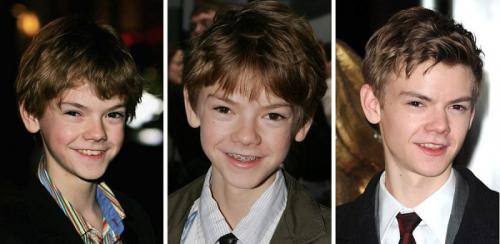 14 звезд до, во время и после брекетов