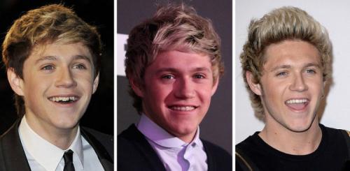 14 звезд до, во время и после брекетов