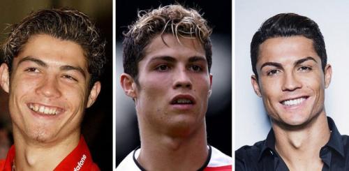 14 звезд до, во время и после брекетов