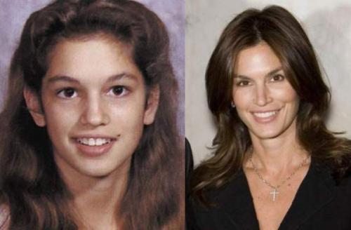 Модели, которые не делали пластику и даже не красили волосы