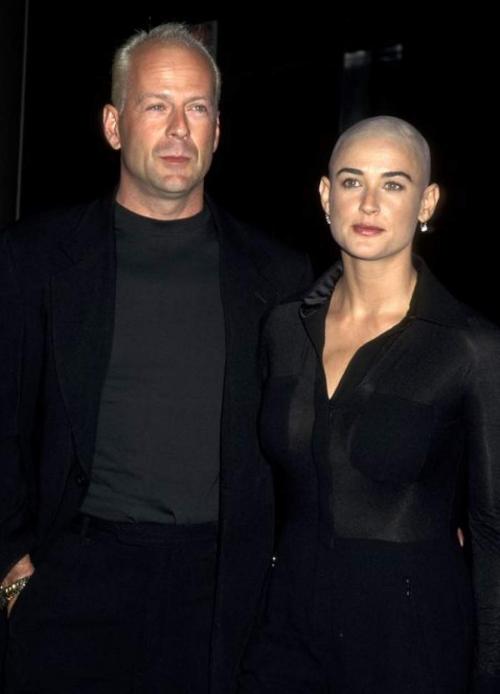 Знаменитые женщины, побрившиеся налысо