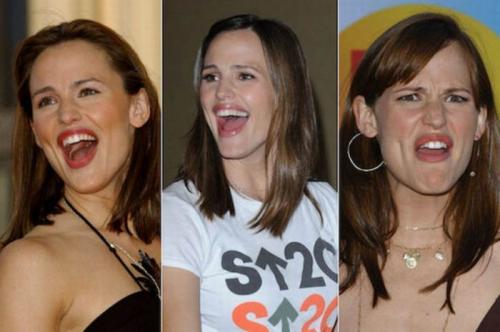 Звезды с широко открытыми ртами