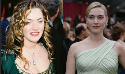 Располневшие знаменитости: что было, что стало