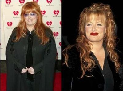 Располневшие знаменитости: что было, что стало