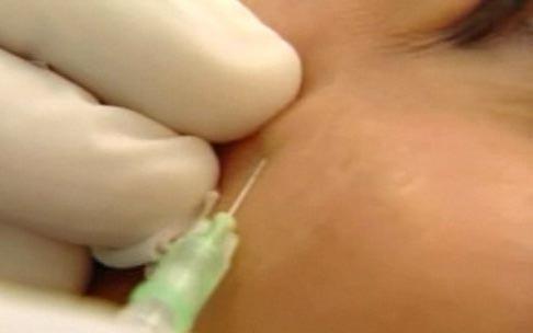 Ким Кардашьян неудачно вколола ботокс