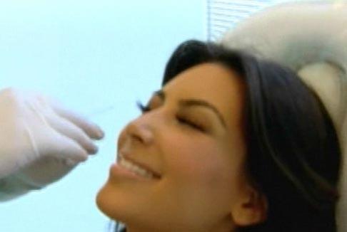 Ким Кардашьян неудачно вколола ботокс