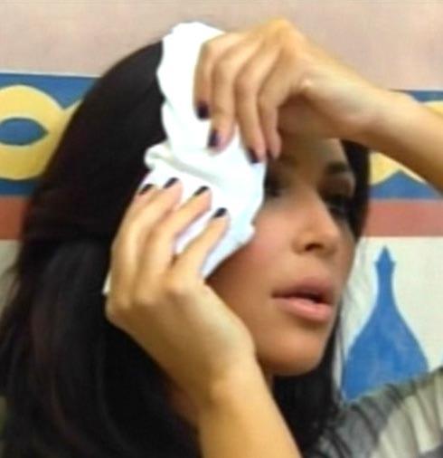 Ким Кардашьян неудачно вколола ботокс