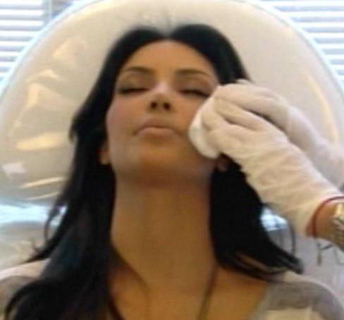 Ким Кардашьян неудачно вколола ботокс