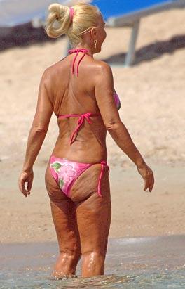 Летнее обострение целлюлита у знаменитостей