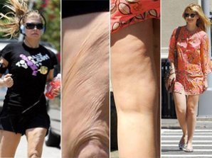 Летнее обострение целлюлита у знаменитостей