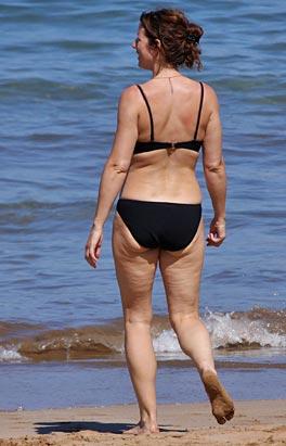 Летнее обострение целлюлита у знаменитостей