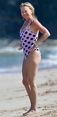 Летнее обострение целлюлита у знаменитостей