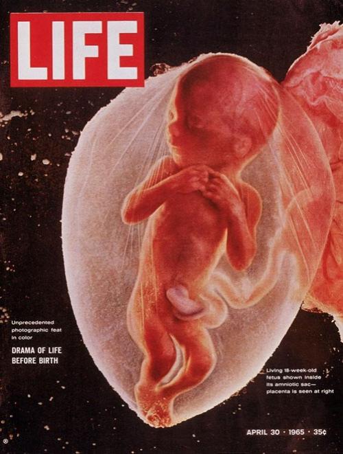 18-  -      . LIFE 30  1965.      " " ('A Child is Born').     8         .