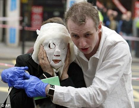 Хирурги сделали новое лицо жертве лондонских терактов