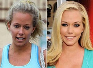 Звезды Голливуда с макияжем и без