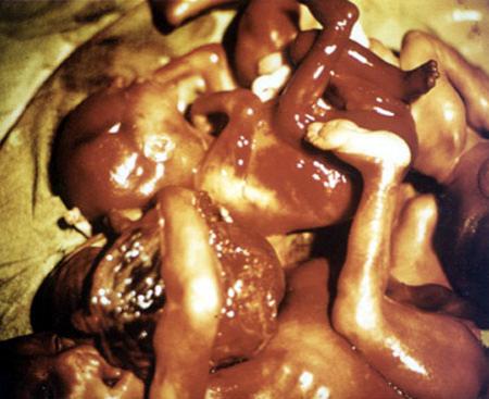 Человеческий эмбрион умеет плакать, зевать и чувствовать смерть. ШОКИРУЮЩИЕ КАДРЫ