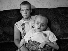 Люди, пострадавшие от "мирного атома"