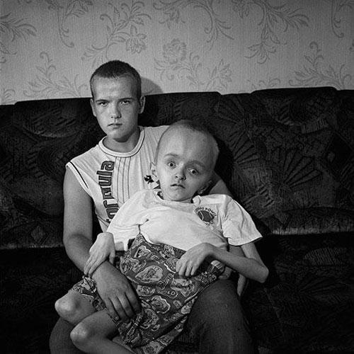 Люди, пострадавшие от "мирного атома"