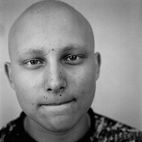 Люди, пострадавшие от "мирного атома"