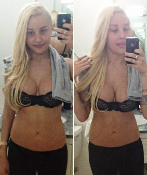 15 голливудских знаменитостей, которые лежали в психбольнице