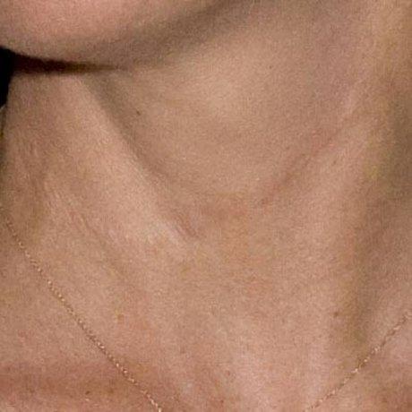 Шрамы знаменитостей