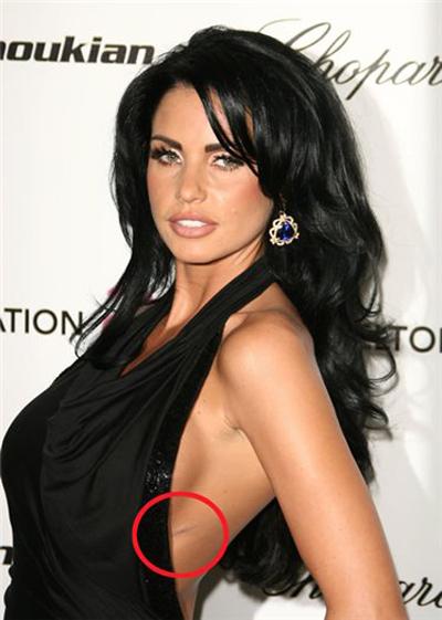 Шрамы знаменитостей