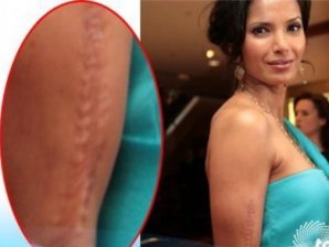 Шрамы знаменитостей