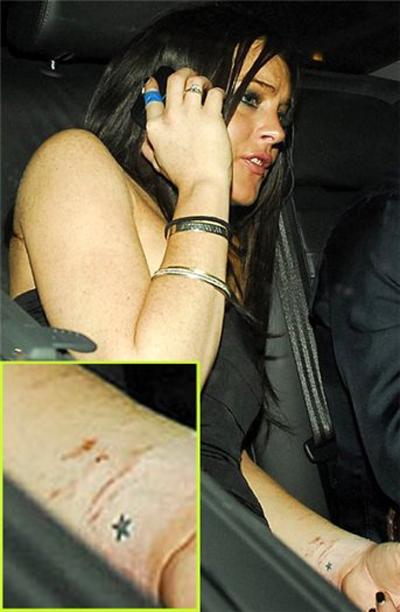 Шрамы знаменитостей