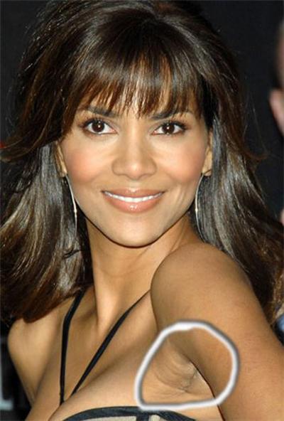 Шрамы знаменитостей