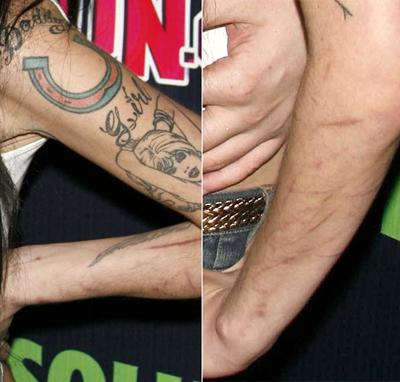 Шрамы знаменитостей